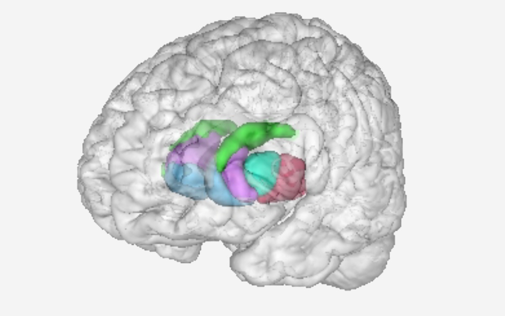 Artificial image of a human brain (from Pauli et al., 2016). The image highlights the striatum and subregions including posterior caudate, ventral striatum, anterior caudate, anterior putamen and posterior putamen